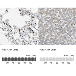 ABCA3 Antibody, Novus Biologicals 0.1mL; Unlabeled:Antibodies, Polyclonal